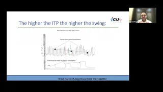 Assessment of Fluid Responsiveness in the Septic Patient