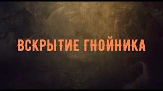 ВСКРЫТИЕ ГНОЙНИКА Кузьмин Юрий - Вячеслав Бойнецкий