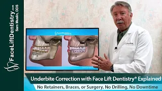 Facelift Dentistry® 8-Day Underbite Fix, No Surgery, Explained