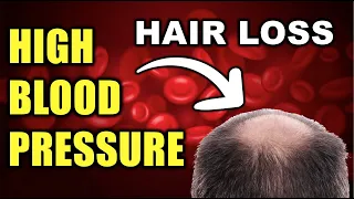 Can High Blood Pressure Cause Hair Loss (Fact or Fiction?)