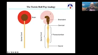 Introduction to Dysautonomia