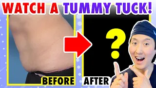 How One Woman Got Rid of Her Extra Tummy Skin! - Dr. Anthony Youn