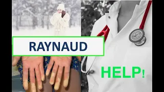 Ik heb koude witte vingers! Fenomeen van Raynaud.