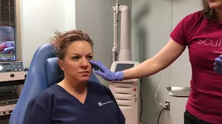 Botox Injections - Anatomy and Technique