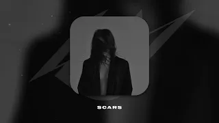 MACAN x Ramil’ x Navai Type Beat - "Scars" | Sad Pop Rap Instrumental 2023