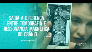 Saiba a diferença entre tomografia e ressonância magnética do crânio