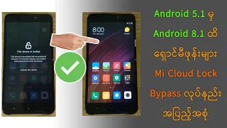 Mi Cloud , Mi Account Remove Bypass , Adb bypass Method Full video ( MM )