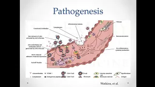 Rheumatic Heart Disease