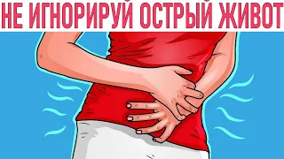 У МЕНЯ БОЛИТ ЖИВОТ | Что такое острый живот и почему при нём надо вызывать скорую как можно быстрее