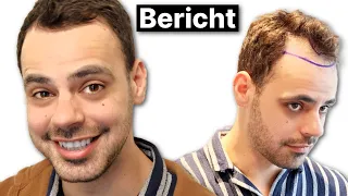 Damirs Bruder lässt sich die Geheimratsecken auffüllen | Haartransplantation Erfahrung