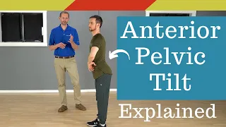 What is Anterior Pelvic Tilt Posture?