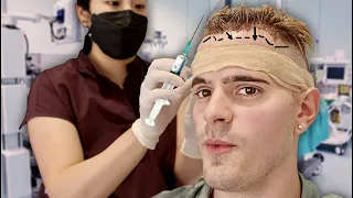 My Hair Transplant Surgery (BEST DECISION EVER)