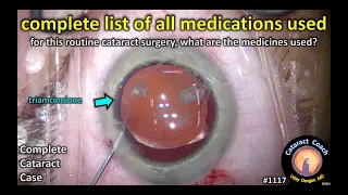 CataractCoach 1117: complete list of medications used in cataract surgery