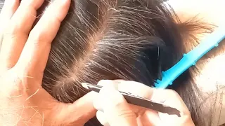 most satisfying dead White hair removal 0.2