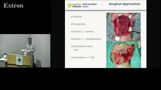 Pharyngeal Space Tumours