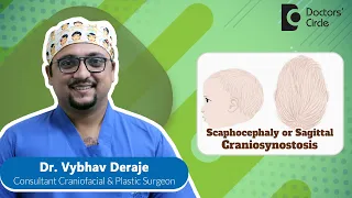 Long & Narrow Head In Baby|Scaphocephaly|Craniosynostosis #newborn -Dr.Vybhav Deraje|Doctors' Circle