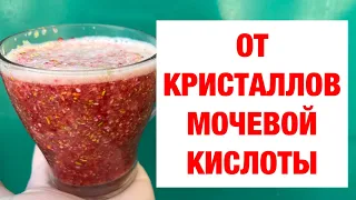 ТАК растворяют Мочевую Даже в 70 лет! еда от Болей в Суставах, Подагры, Камней в Почках.