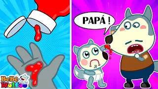 ¡Papá, Al bebé Wolfoo le duele la mano! Lección de seguridad infantil - Dibujos animados para niños