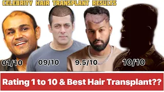 CELEBRITIES WHO HAD THEIR HAIR TRANSPLANT | Hair Transplant Results