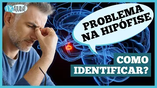 SERÁ QUE TENHO ALGUM PROBLEMA NA HIPÓFISE? 🧠 #cerebrohumano  #hormônios