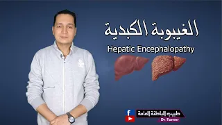 الغيبوبة الكبدية / hepatic encephalopathy