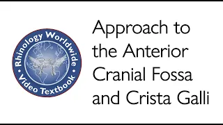 Approach to the Anterior Cranial Fossa and Crista Galli - Dr. Marc Rosen