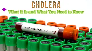 Cholera: What It Is and What You Need to Know