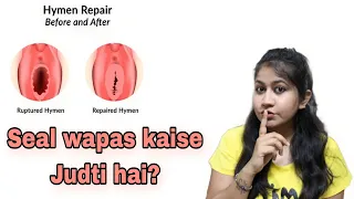 Female's seal reconstruction महिला की सील टूटने के बाद फिर से कैसे जुड़ती है? | Tanushi and family