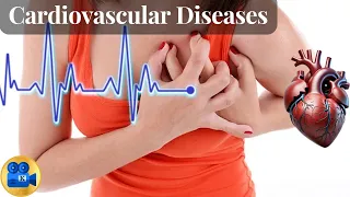 Cardiovascular diseases (Heart Attacks): Causes, Diagnosis and Treatment