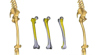 [Webcast] - Modeling subject-specific femoral torsion for the analysis of lower-limb joint loads