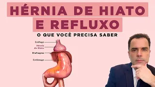 Hérnia de Hiato e Refluxo! O que é e qual o tratamento? Dr. Fernando Lemos, Coloproctologista.