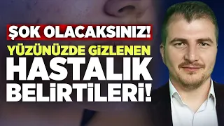 ŞOK OLACAKSINIZ! "Mide Anne Demektir!" Yüzünüzde Gizlenen Hastalık Belirtileri! | Ahmed Burak