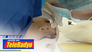 7 sa bawat 10 Pinoy dumaranas ng pagkabulok ng ngipin | Headline Pilipinas (22 Feb 2023)