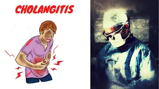 Cholangitis