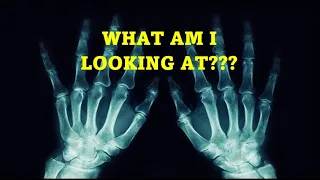 X-Ray vs. CT vs. MRI - What's the Difference? | Doctor Squared