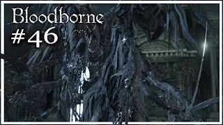 Bloodborne [RU/PS4] #46 - Кормилица Мерго