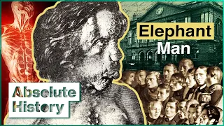 The Elephant Man: Victorian Era's Most Tragic Figure | Hidden History of Britain | Absolute History