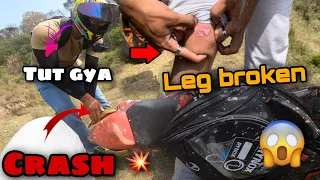 Leg broke in Bike Crash 😡|Saksham Manhas| #fight #crash #broken @MehrabSheikh