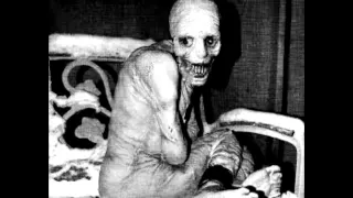 The Russian Sleep Experiment