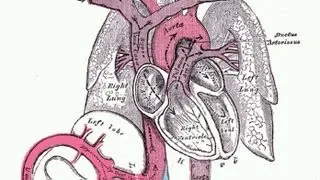 Why does Aortic Rupture cause so many deaths?