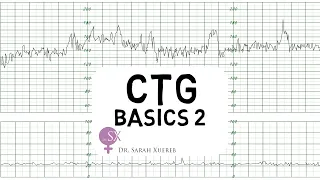 CTG Basics Part 2 - Decelerations & Fetal Physiology