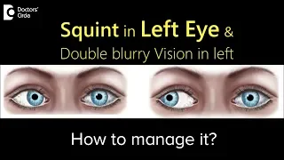Management of Squint in Left Eye & Double blurry Vision in left?- Dr. Sunita Rana Agarwal
