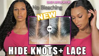 🔥This is SCALP! | Easily Hide Grids and Knots NO BLEACH on WIG (WHAT LACE?)