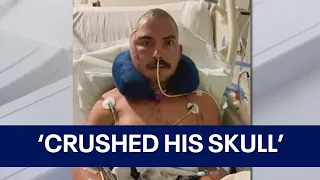 Florida man survives after alligator bites his head, 'punctured his brain'