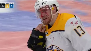 Zdeno Chara bloodies Yakov Trenin in one sided bout