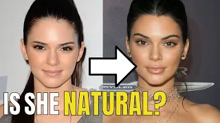 Kendall Jenner: Plastic Surgery