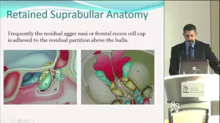 Why FESS Fails by Rick Chandra, MD