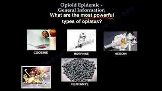 Opioid Epidemic General Information - Everything You Need To Know - Dr. Nabil Ebraheim