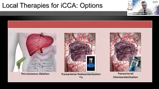 Webinar:  Can local therapies help patients with intrahepatic cholangiocarcinoma?
