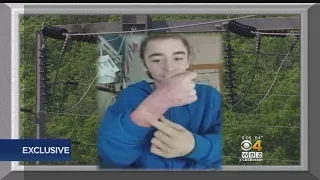 Teen Who Survived Fall Onto 115,000 Volt Line Is Thankful To Be Alive